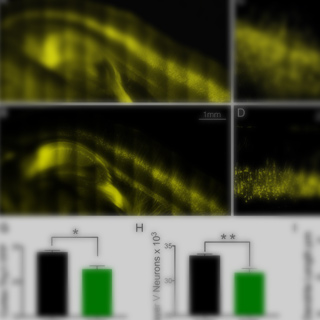 Bringing CLARITY to gray matter atrophy.