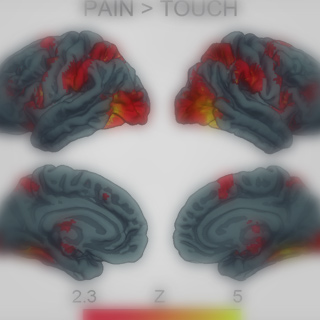 Deontological Dilemma Response Tendencies and Sensorimotor Representations of Harm to Others