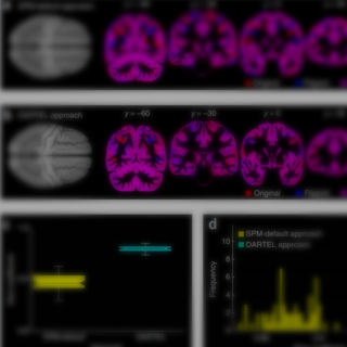 A 12-step user guide for analyzing voxel-wise gray matter asymmetries in statistical parametric mapping (SPM).