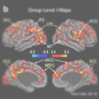 Dynamic and static contributions of the cerebrovasculature to the resting-state BOLD signal.